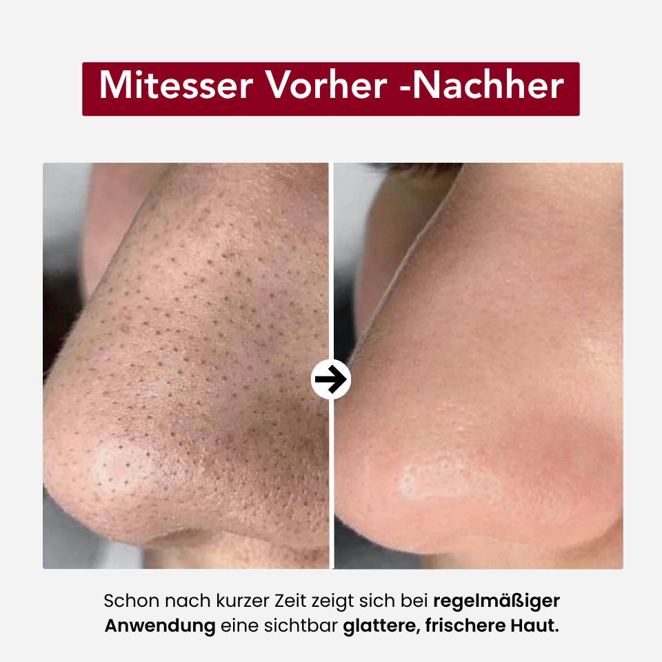 Nana's - Rice Peeling Glow Serum